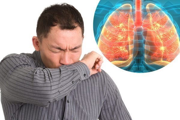 Tuberculose