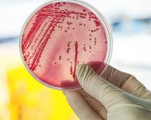 alx_disco_com_bacterias_original2 Resistência microbiana