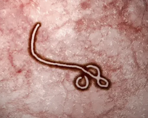 o-ebola-um-dos-virus-mais-fatais-mundo-54762eaee75e9 EBOLA
